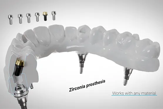 Vídeo Flat Screw de DESS