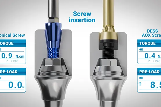 Vídeo Flat Screw de DESS